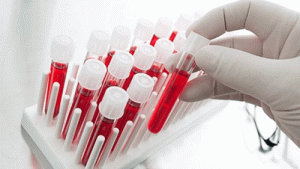 Ngành Kỹ thuật Xét nghiệm có vai trò đặc biệt quan trọng