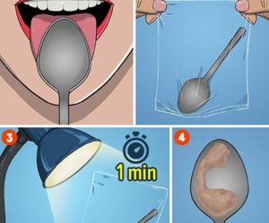 Các bước để chuẩn đoán bệnh với 1 chiếc thìa