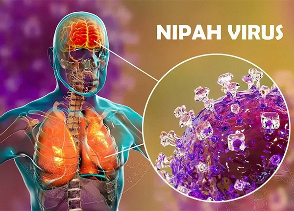 Hiểu đúng virus Nipah con đường lây nhiễm biểu hiện bệnh và phòng ngừa