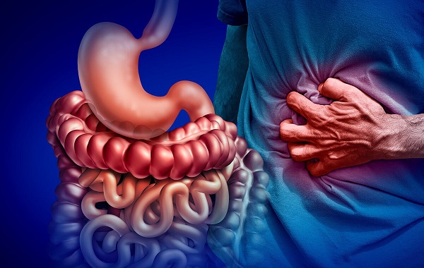 Bệnh Crohn: Triệu chứng và điều trị bệnh lý