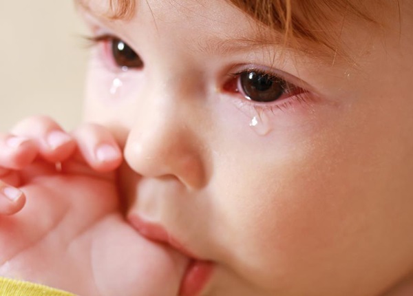 Điểm danh những dấu hiệu điển hình khi trẻ bị bệnh đau mắt đỏ